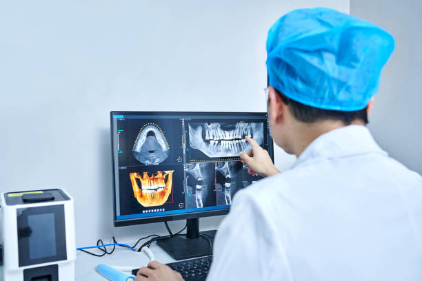 Best Emergency Tooth Extraction in Boyes Hot Springs, CA