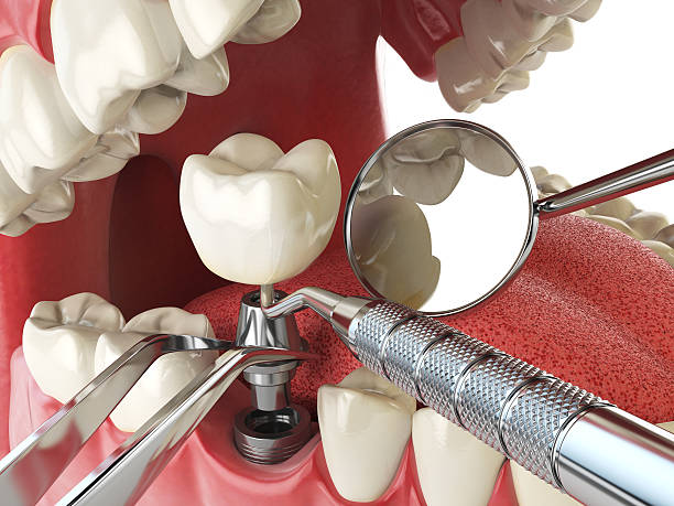 Best Weekend Emergency Dentist in Boyes Hot Springs, CA