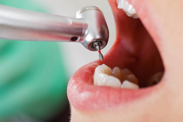 Best Pediatric Emergency Dentist in Boyes Hot Springs, CA